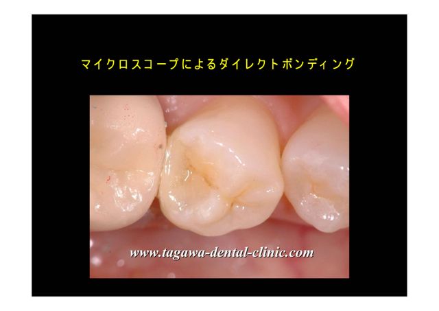 治療後の形態を8倍で確認している画像